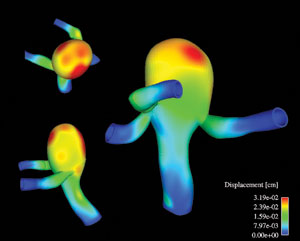 Computing - 3-D blood-flow animations