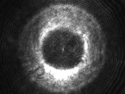 Down to the Atom - Staphylococcus aureus