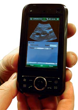 Tech Focus - Ultrasound image on a smart phone