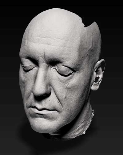 Part of the Solution - CT scans help make exact-fit cranial implants
