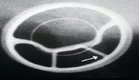 Safety First? - Stresses led to failure of the joints